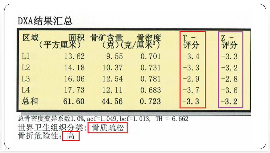 HIV感染者骨质疏松诊断及治疗