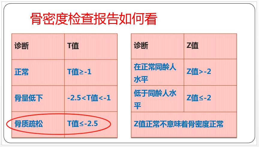 HIV感染者骨质疏松诊断及治疗