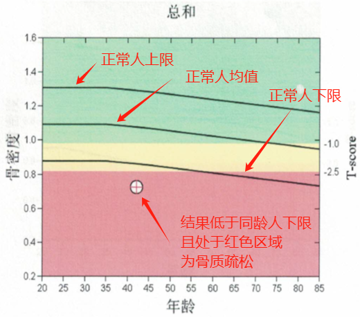 HIV感染者骨质疏松诊断及治疗